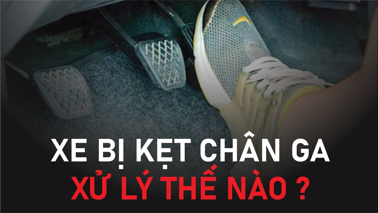 xe bi kết chan ga